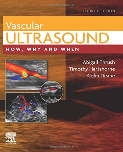 Download Book Vascular Ultrasound: How, Why and When 4th Edition, Abigail Thrush, Timothy Hartshorne, Colin Richard Deane, 0702046566, 0702081884, 978-0702081880, 9780702081880, 978-0702046568, 9780702046568, B09PDZWFDL
