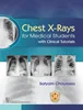 Chest X-ray for Medical Students with Clinical Tutorials, Satyam Chaurasia, B0BSBQV35V