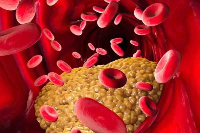 Most U.S. Adults Will Have Heart Problems By 2050: Report