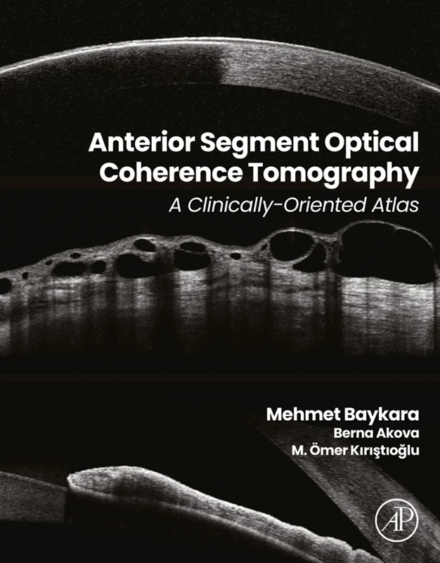 Anterior Segment Optical Coherence Tomography: A Clinically-Oriented Atlas