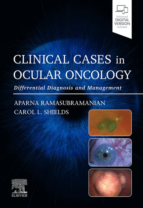 Clinical Cases in Ocular Oncology: Differential Diagnosis and Management