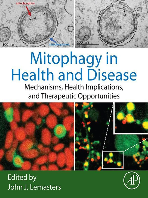 Mitophagy in Health and Disease: Mechanisms, Health Implications, and Therapeutic Opportunities