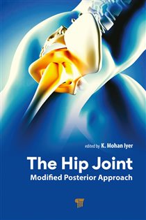The Hip Joint Modified Posterior Approach