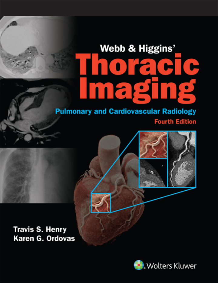 Webb & Higgins Thoracic Imaging 4th Edition