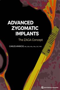 Advanced Zygomatic Implants The ZAGA Concept