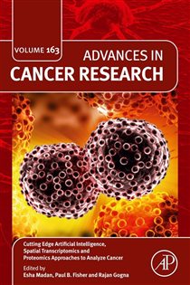 Cutting Edge Artificial Intelligence, Spatial Transcriptomics and Proteomics Approaches to Analyze Cancer