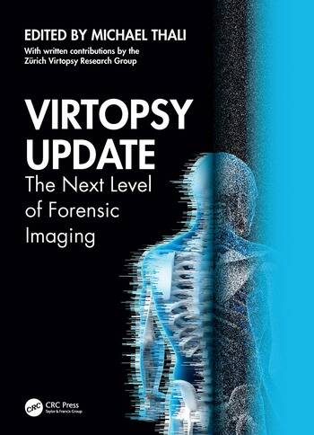 Virtopsy Update The Next Level of Forensic Imaging Edited By Michael Thali