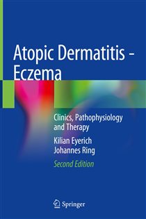 Atopic Dermatitis - Eczema (2nd ed.) Clinics, Pathophysiology and Therapy