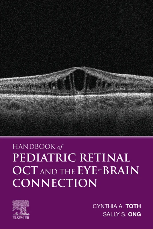 Handbook of Pediatric Retinal OCT and the Eye-Brain Connection