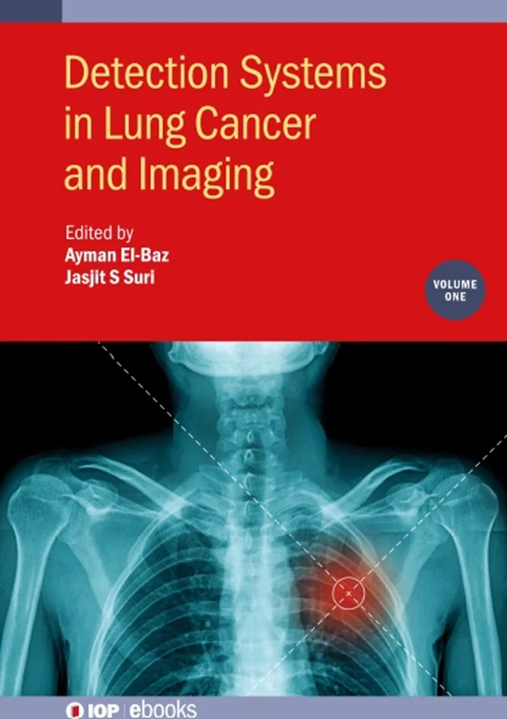 Detection Systems in Lung Cancer and Imaging