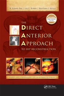 The Direct Anterior Approach to Hip Reconstruction