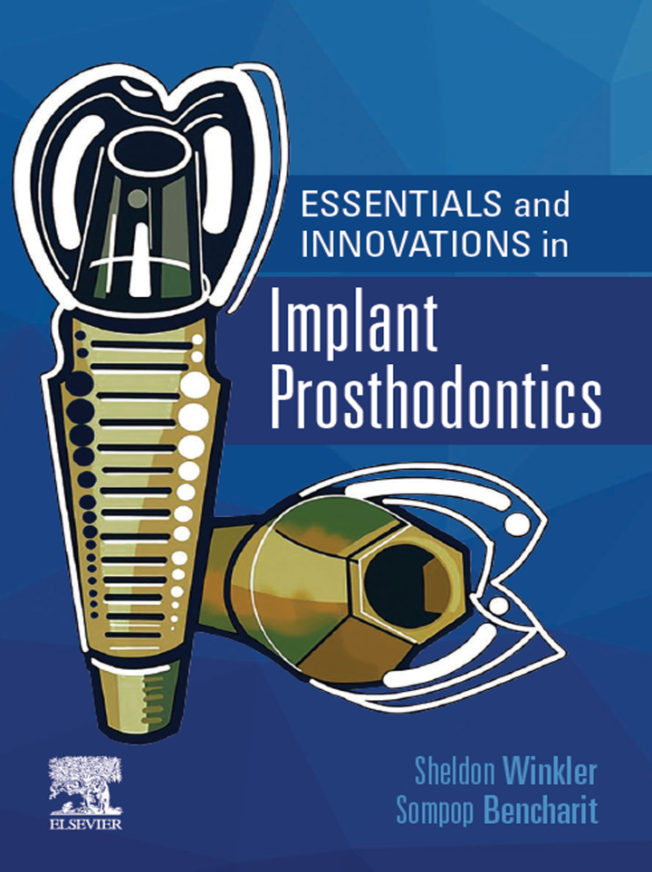 Essentials and Innovations in Implant Prosthodontics