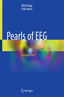 Pearls of EEG (2nd ed.)