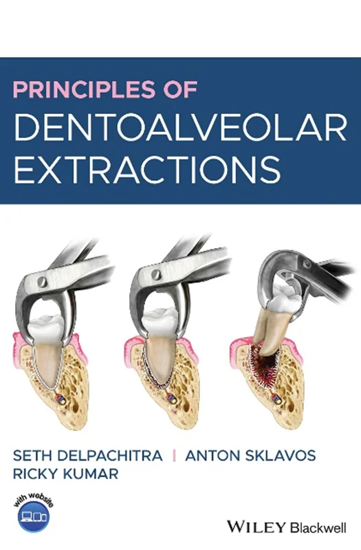 Principles of Dentoalveolar Extractions