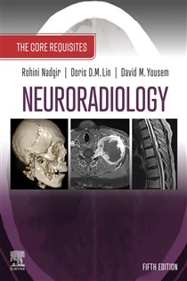 Neuroradiology: The Requisites E-Book (5th ed.) The Core Requisites