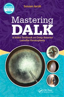 Mastering DALK A Video Textbook on Deep Anterior Lamellar Keratoplasty