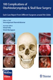 100 Complications of Otorhinolangyngology & Skull Base Surgery Each Case Report from Different Surgeons around the Globe