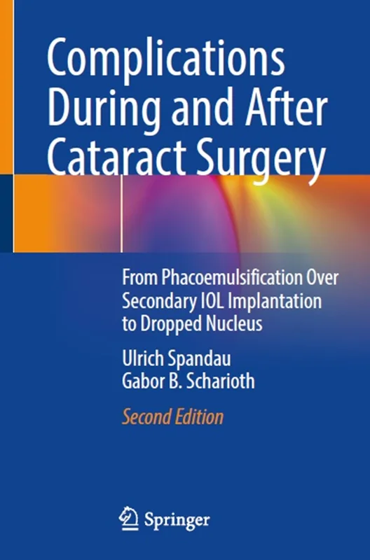 Complications During and After Cataract Surgery: From Phacoemulsification Over Secondary IOL Implantation to Dropped Nucleus