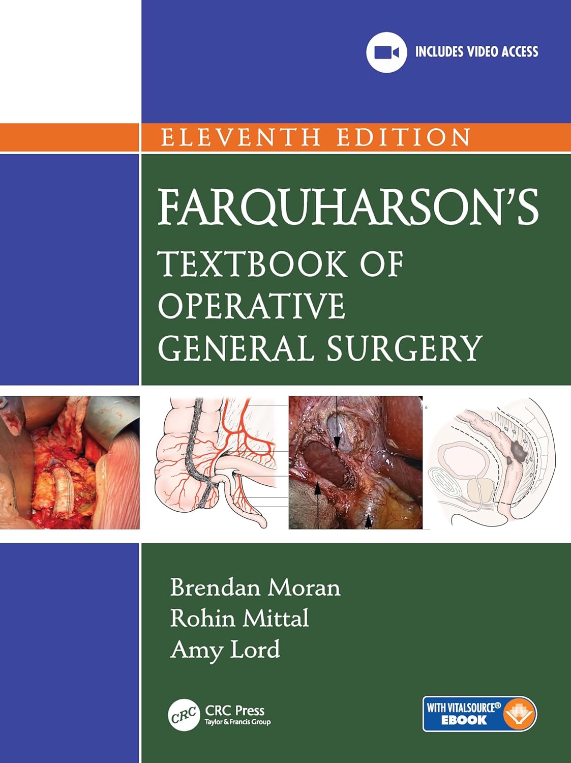 Farquharson's Textbook of Operative General Surgery 11th Edition