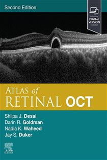 Atlas of Retinal OCT E-Book (2nd ed.) Optical Coherence Tomography