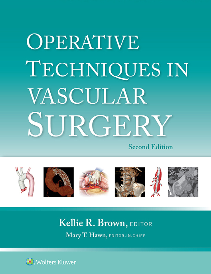 Operative Techniques in Vascular Surgery 2nd Edition