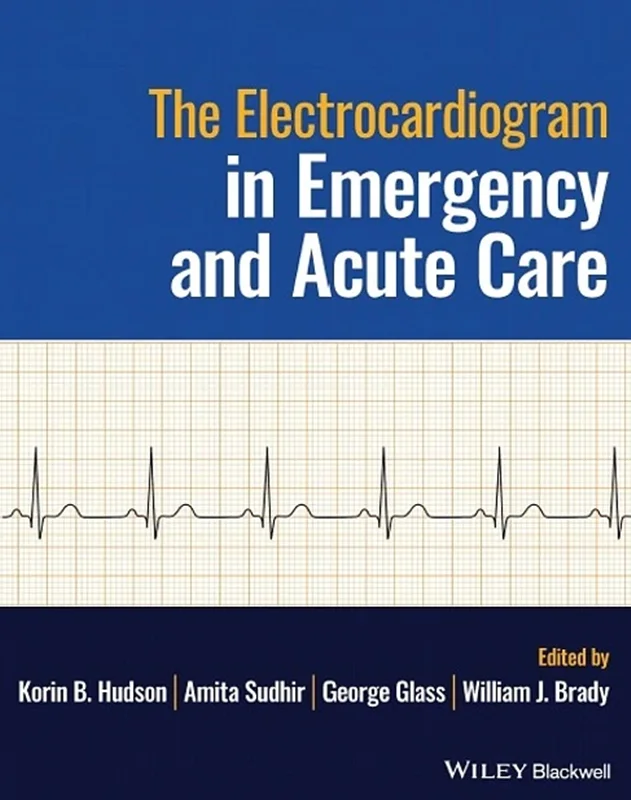 The Electrocardiogram in Emergency and Acute Care