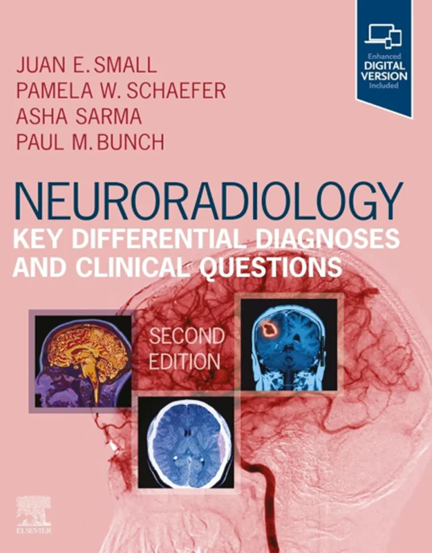 Neuroradiology: Key Differential Diagnoses and Clinical Questions 2nd Edition