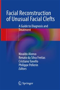 Facial Reconstruction of Unusual Facial Clefts A Guide to Diagnosis and Treatment