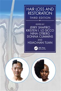 Hair Loss and Restoration (3rd ed.)