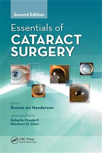 Essentials of Cataract Surgery (2nd ed.)