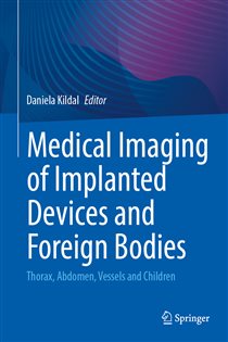 Medical Imaging of Implanted Devices and Foreign Bodies Thorax, Abdomen, Vessels and Children