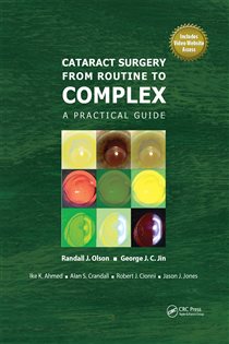 Cataract Surgery from Routine to Complex A Practical Guide