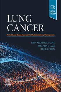 Lung Cancer E-Book An Evidence-Based Approach to Multidisciplinary Management