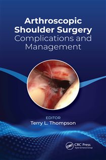 Arthroscopic Shoulder Surgery Complications and Management