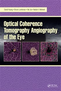 Optical Coherence Tomography Angiography of the Eye OCT Angiography