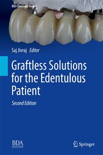 Graftless Solutions for the Edentulous Patient (2nd ed.)
