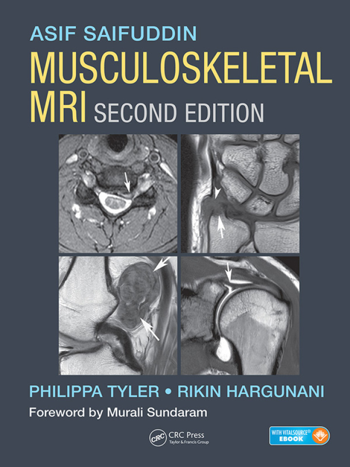Musculoskeletal MRI 2nd Edition