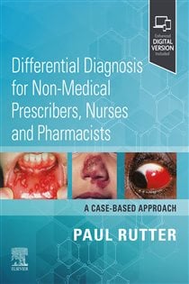 Differential Diagnosis for Non-medical Prescribers, Nurses and Pharmacists: A Case-Based Approach - E-BOOK